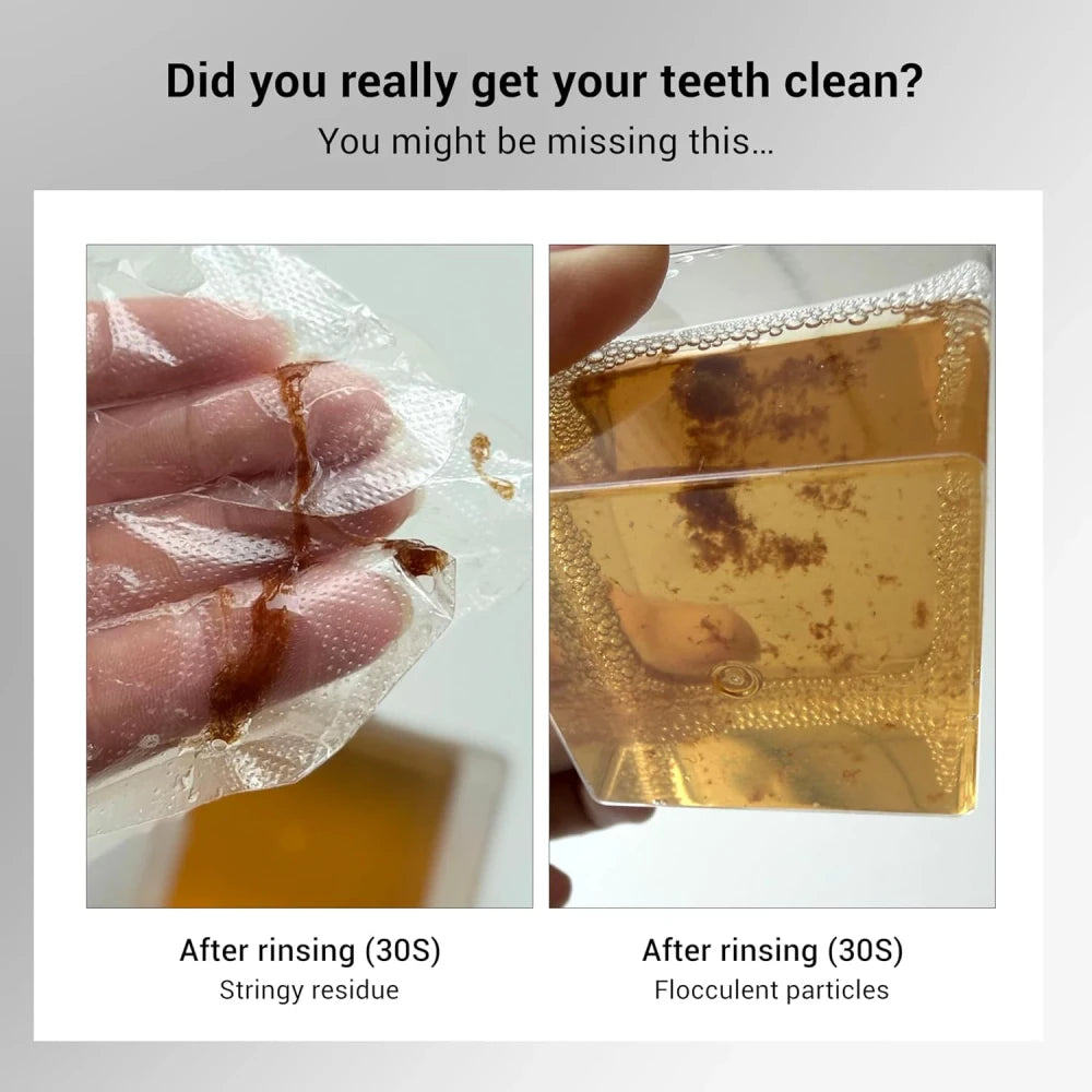 Alcohol Free Whitening Mouthwash